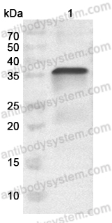 Anti-Monkeypox virus/MPXV B6R/SL-159 Polyclonal Antibody